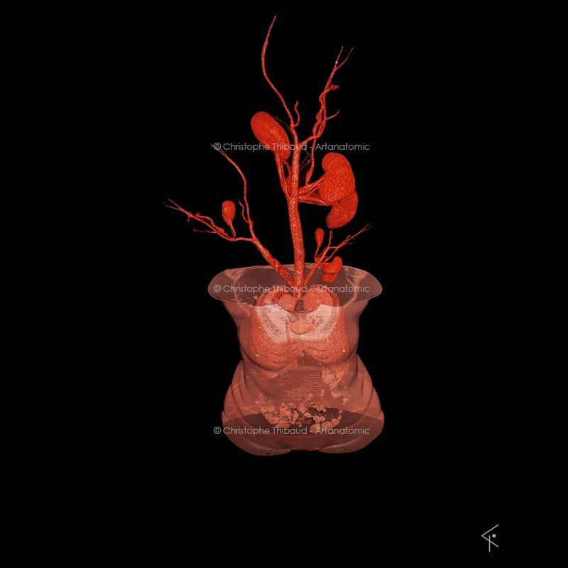 A kind of vase